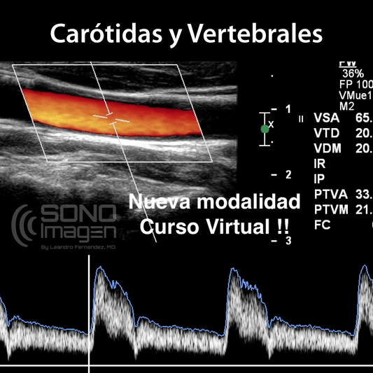 Curso Doppler Carótidas y Vertebrales MODO VIRTUAL