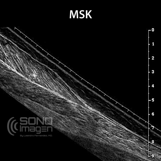 Curso MSK 1 Miembro superior. MODO VIRTUAL